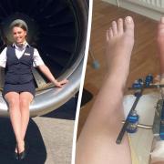 Air hostess Eden broke her leg in seven places following the heavy turbulence